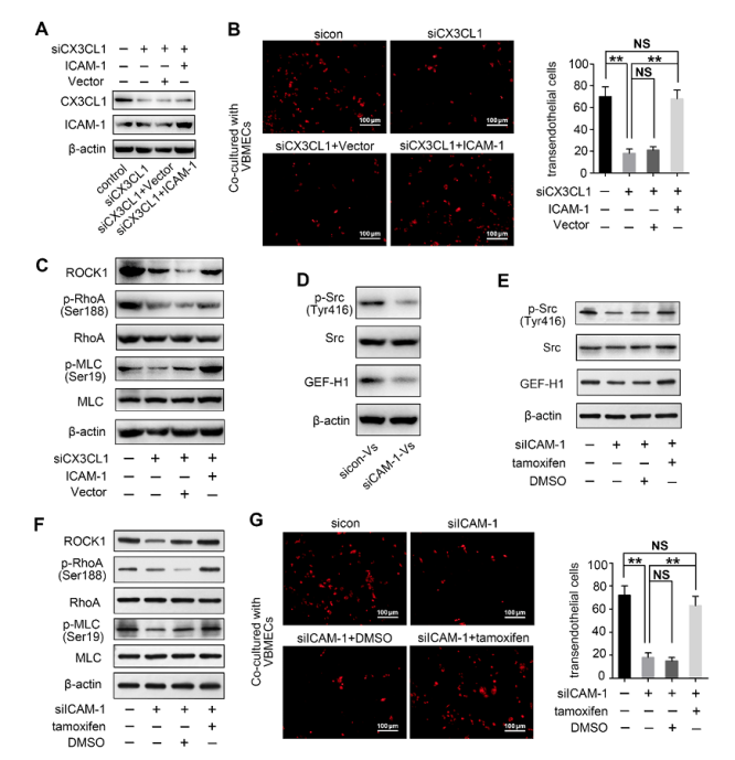 預防NSCLC脊柱轉移的潛在新靶點