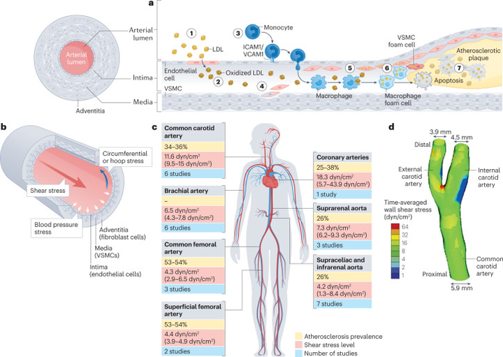 動(dòng)脈粥樣硬化中血流誘導(dǎo)的內(nèi)皮細(xì)胞重編程