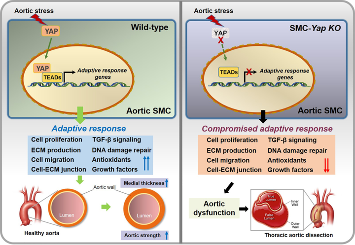 小鼠主動(dòng)脈應(yīng)力激活胸主動(dòng)脈平滑肌細(xì)胞中的適應(yīng)性程序，維持主動(dòng)脈強(qiáng)度并防止動(dòng)脈瘤和夾層