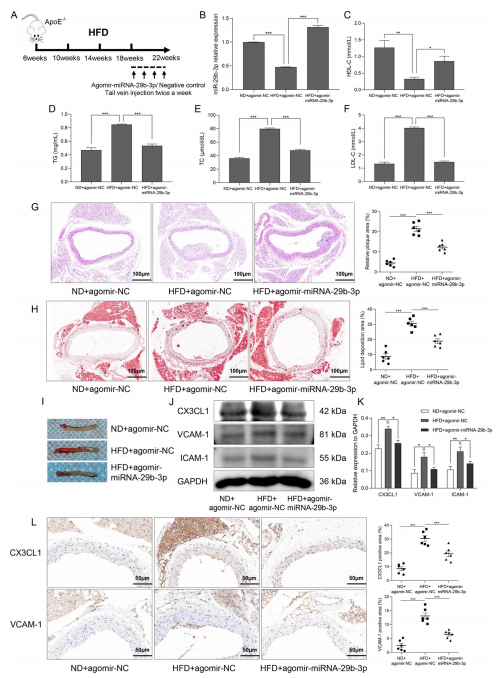 層流剪切應(yīng)力通過(guò)調(diào)控 miR - 29b - 3p/CX3CL1 軸減輕單核細(xì)胞黏附及動(dòng)脈粥樣硬化發(fā)展